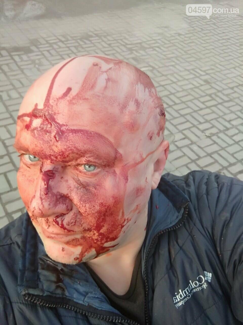 Скандально відомому "догхантеру" з Києва проломили голову, фото-1 Скандально відомому "догхантеру" з Києва проломили голову, фото-1