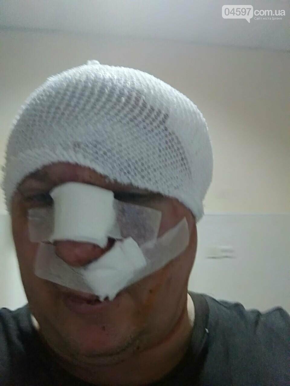 Скандально відомому "догхантеру" з Києва проломили голову, фото-2 Скандально відомому "догхантеру" з Києва проломили голову, фото-2