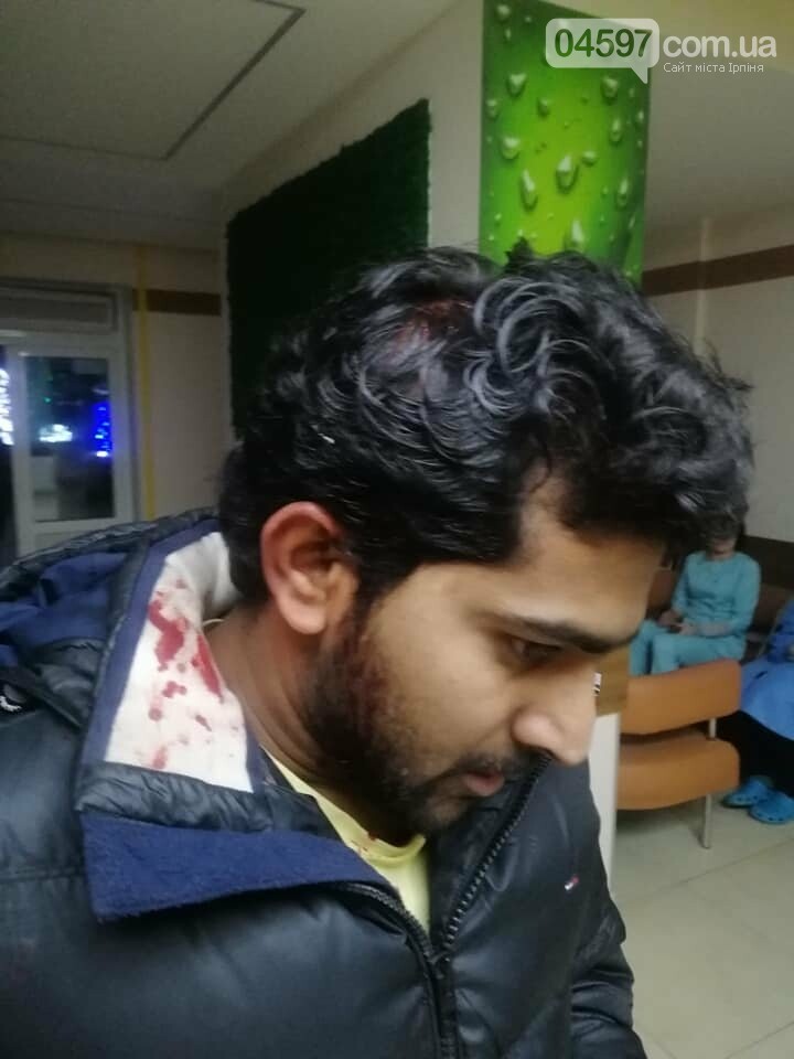 В Бучі жорстоко побили громадянина Індії, фото-1 В Бучі жорстоко побили громадянина Індії, фото-1